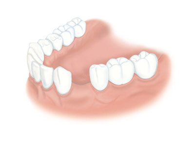 Oralchirurgie